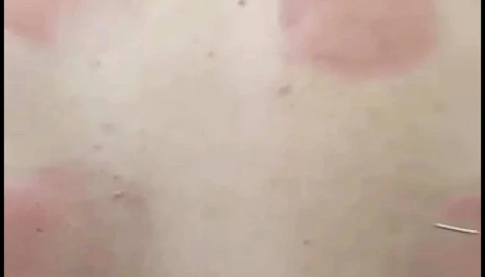 Clinica De Estetica Spa Beleza Top Centro De Saude E Beleza - Porciúncula